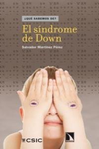 El síndrome de Down El síndrome de Down